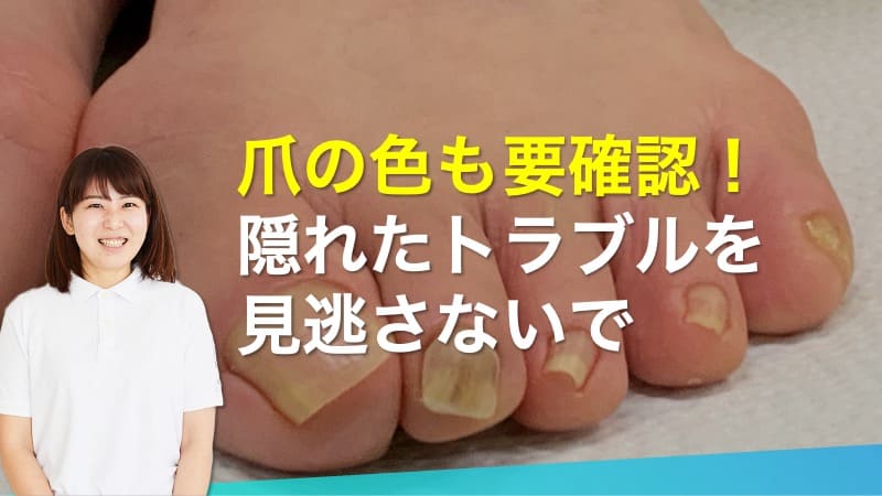 爪の色も要確認！隠れたトラブルを見逃さないで